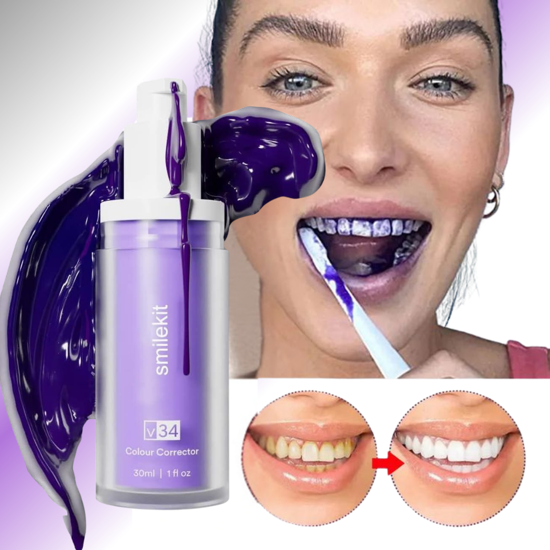 Smile - Blanqueador Dental V34