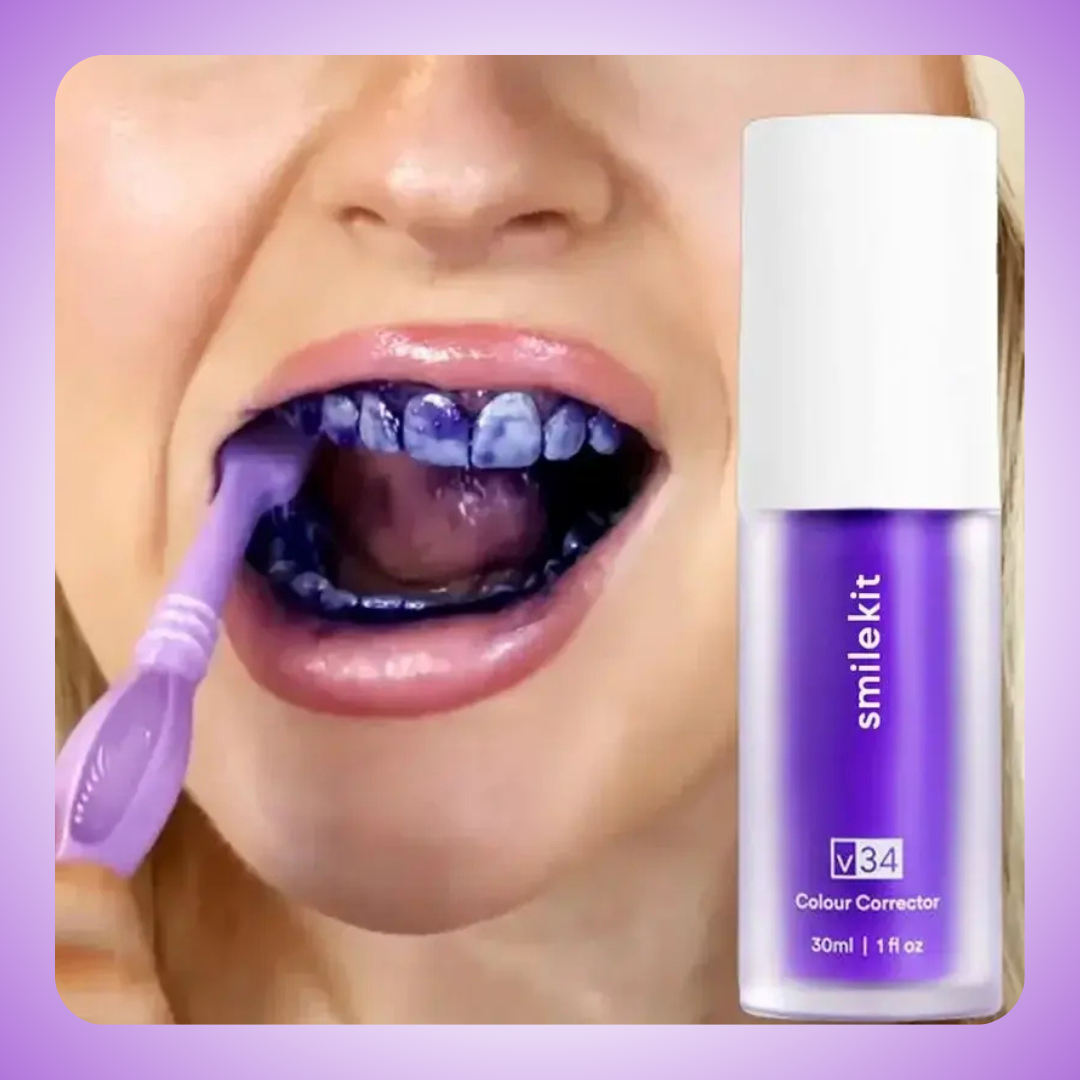 Smile - Blanqueador Dental V34
